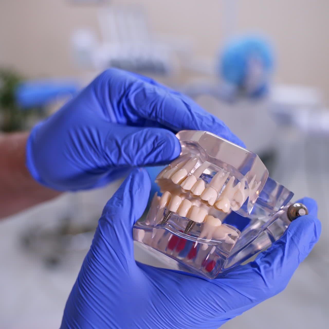Doctor shows fake implants on a plastic jaw sample or model. Modern dental clinic background. Blue medical gloves on doctor's hands. Dental Hygiene and Health concept video. Implants in jaw.
