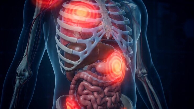 Transparent human torso with multiple glowing red pain hotspots in shoulder, chest and abdomen, 3D medical anatomy visualization