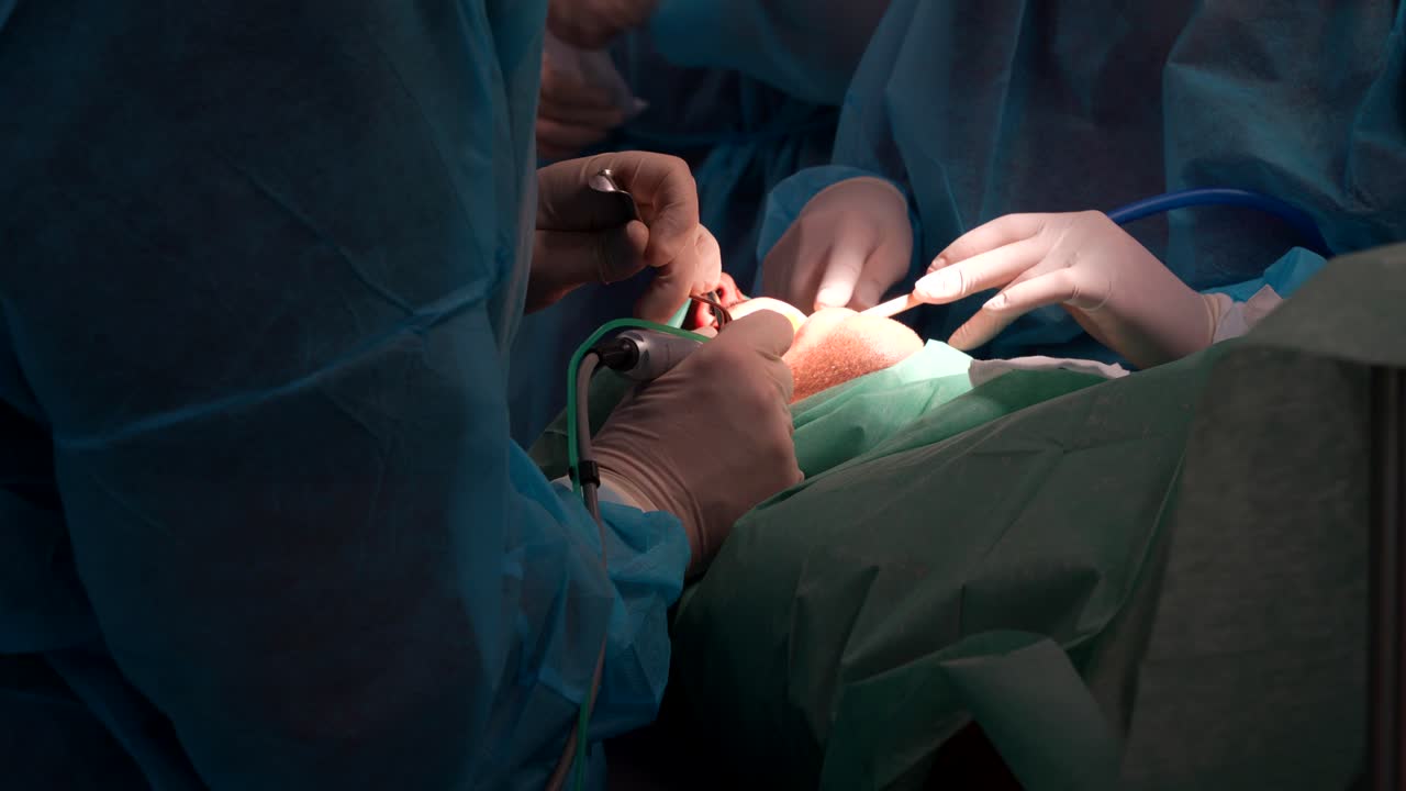 Dental surgeon operating on a patient with a team in a sterile surgical environment