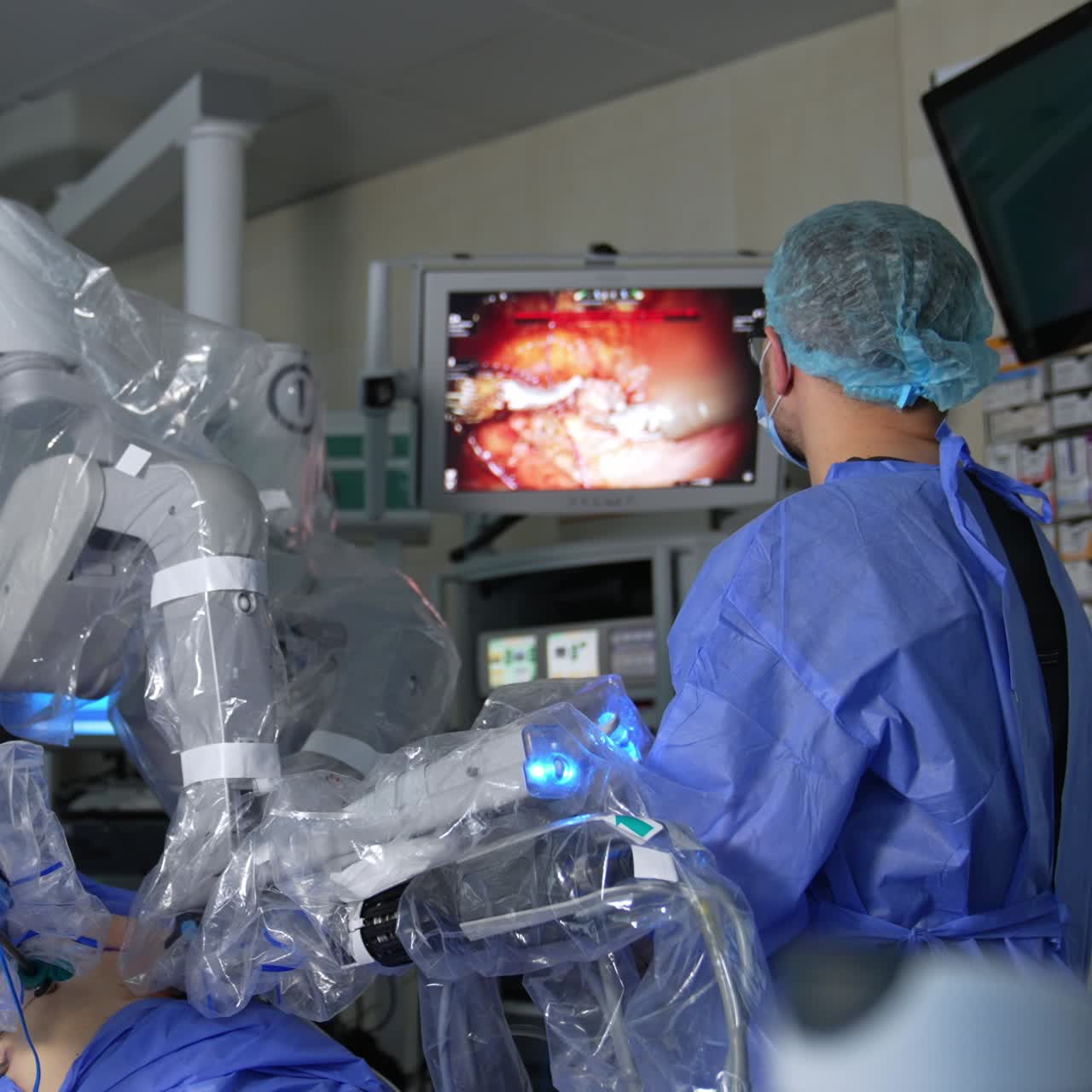 Innovative surgical equipment performing surgery in modern hospital. Male surgeon controls the procedure on the screen