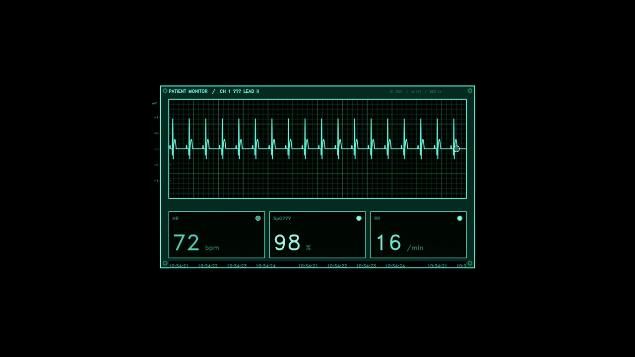 A cyan digital patient monitor interface featuring an ECG waveform, heart rate, SpO2, and respiratory rate readouts on a grid. Animated medical data panel loops for compositing.