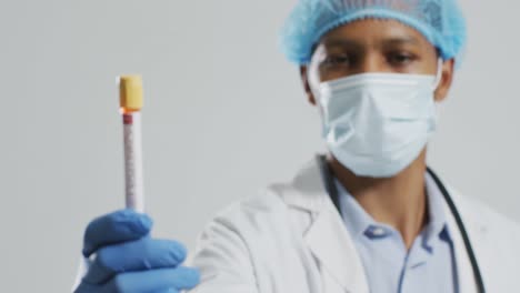 médico afroamericano de sexo masculino con máscara facial, sosteniendo un vial con el virus de la viruela del mono