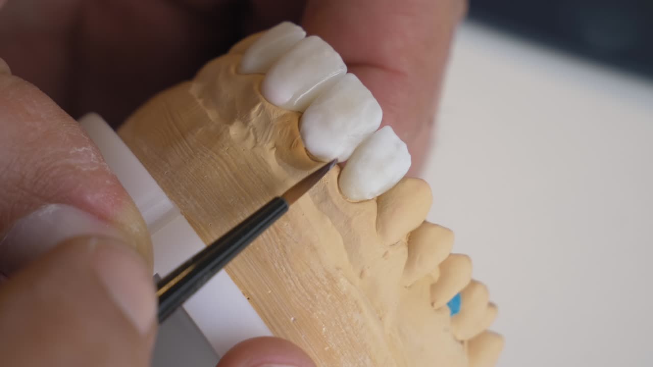 Dental Technician Working on a Dental Model