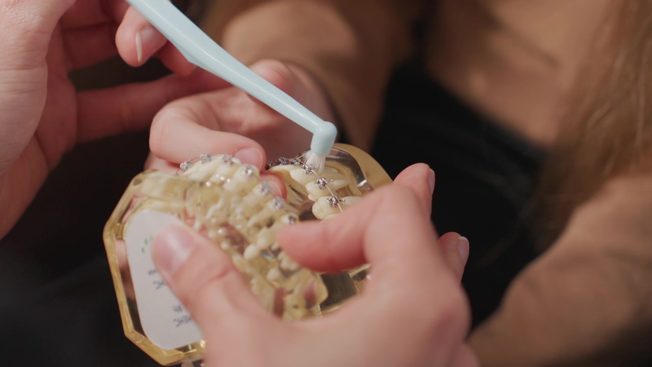 Close-up van volwassene die een kind de juiste mondhygiëne demonstreert met behulp van een model met beugel. Volwassen hand houdt plastic tanden vast terwijl er rond orthodontische beugels wordt gepoetst, wat de juiste techniek toont.