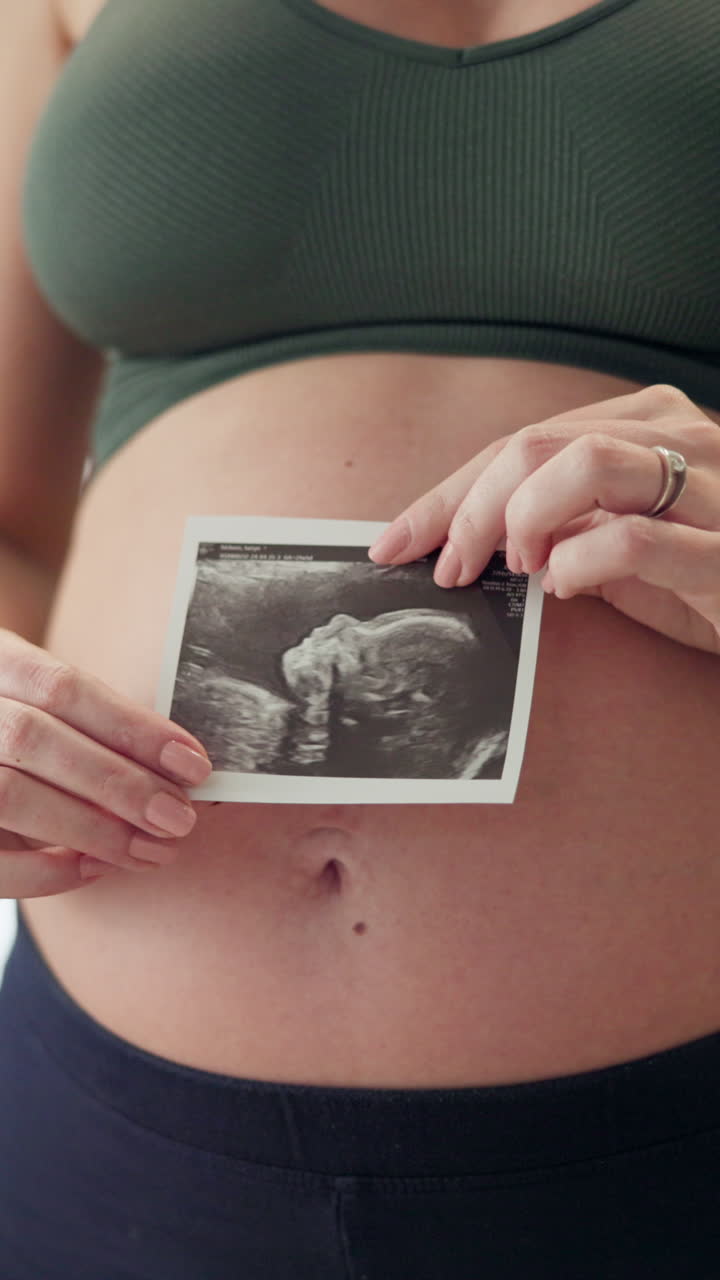 Una donna incinta che tiene in mano una foto dell'ecografia del suo bambino.