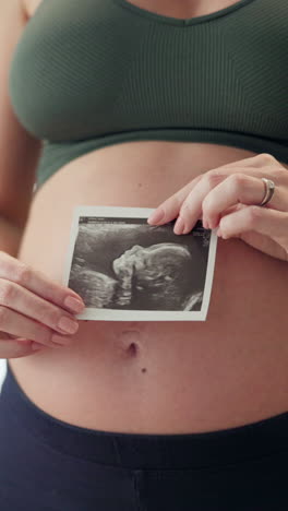 a pregnant woman holding an ultrasound photo of her baby