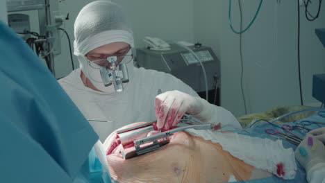 doctor during laser heart procedure. surgeon performs coronary artery bypass surgery in modern operating room using laser scalpel for enhanced accuracy