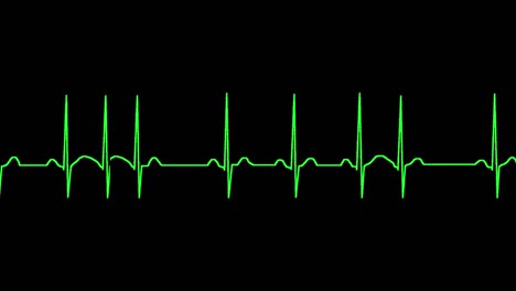 el ecg muestra arritmia sinusal