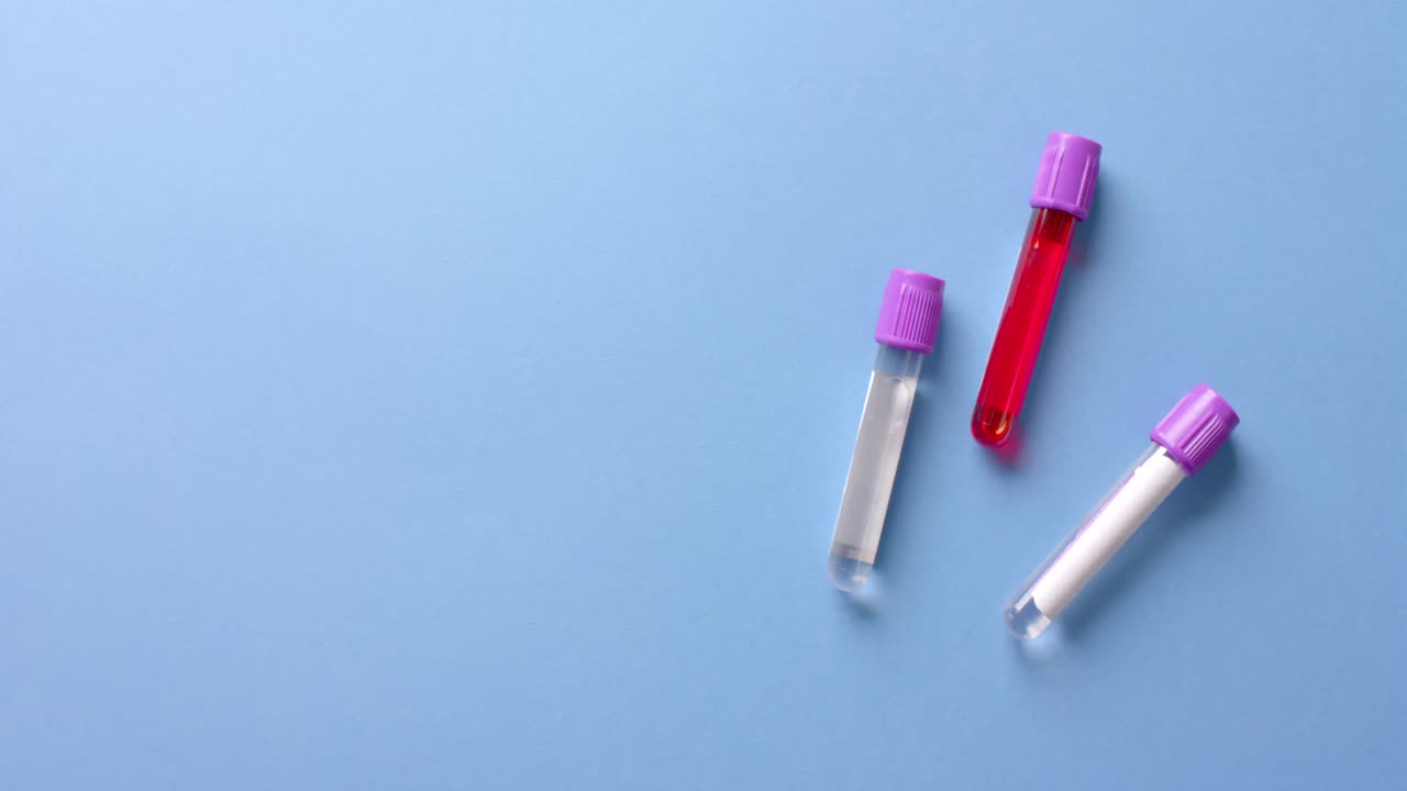 primo piano di campioni di sangue su sfondo blu con spazio di copia, slow motion