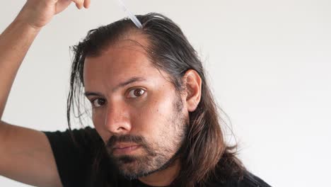 man applying minoxidil to hair with dropper, baldness, serum