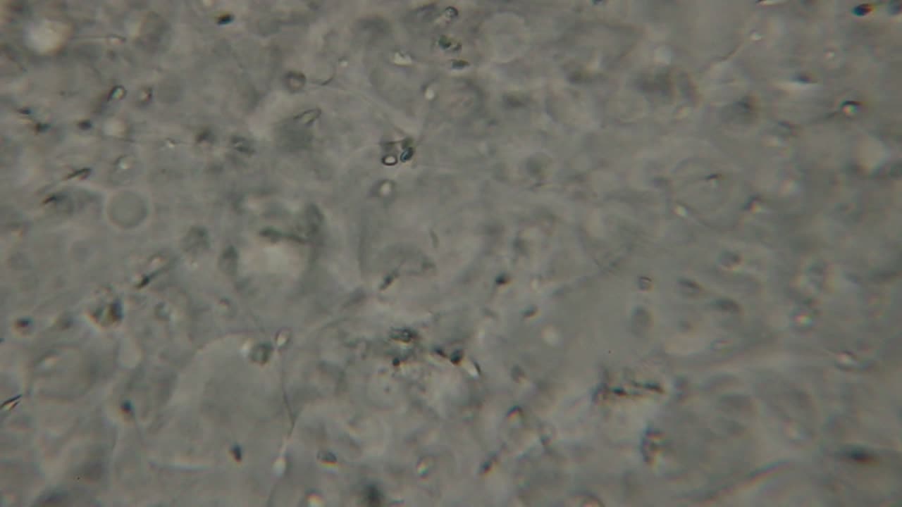 Microscopic view of moving human sperm cells with visible heads and flagella against a light background, commonly used in fertility and reproductive studies