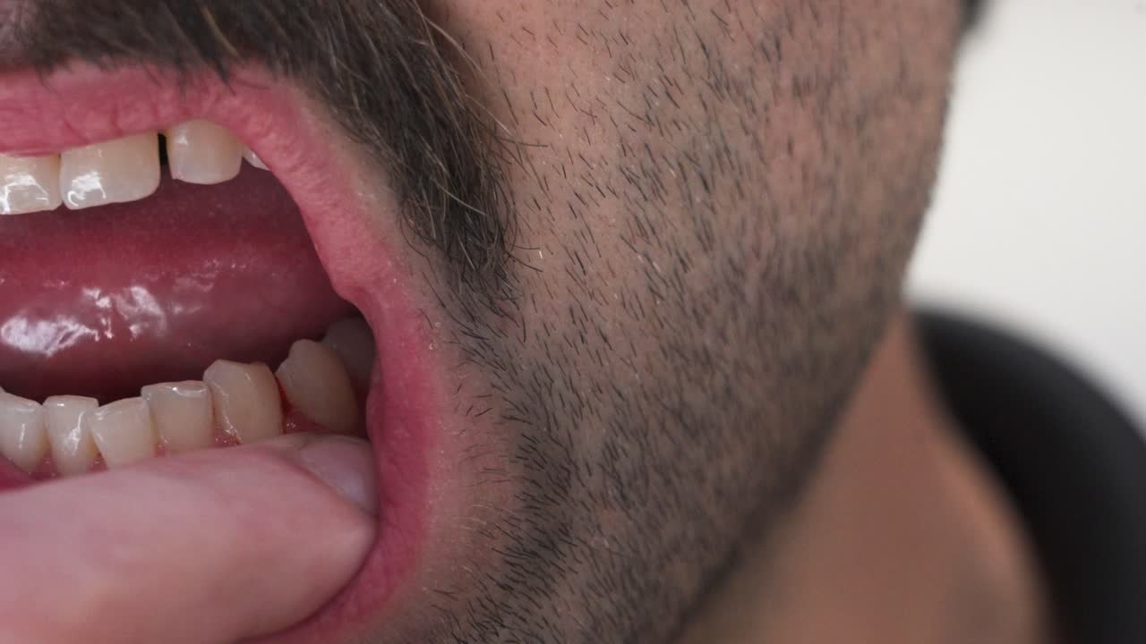 Close up look at slightly unhealthy gums