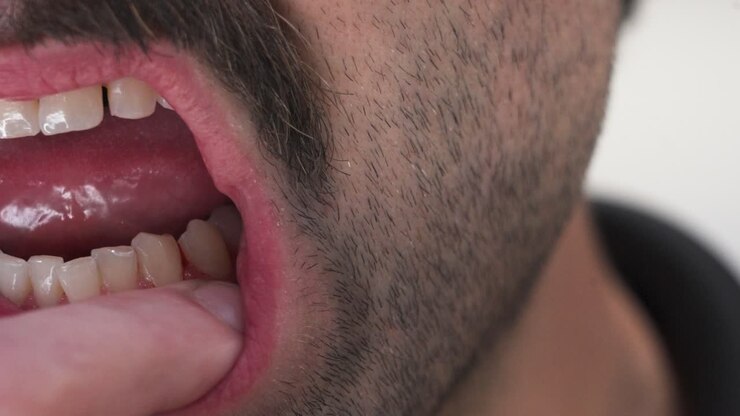 Close up look at slightly unhealthy gums