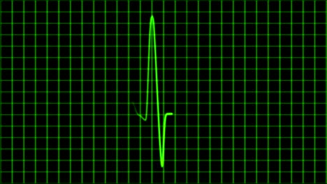 cardiogram cardiograph oscilloscope screen loop 4k