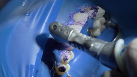 pastas de pulido con pulido dental durante la limpieza dental
