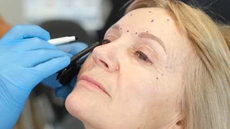 cosmetic procedure marking for facelift