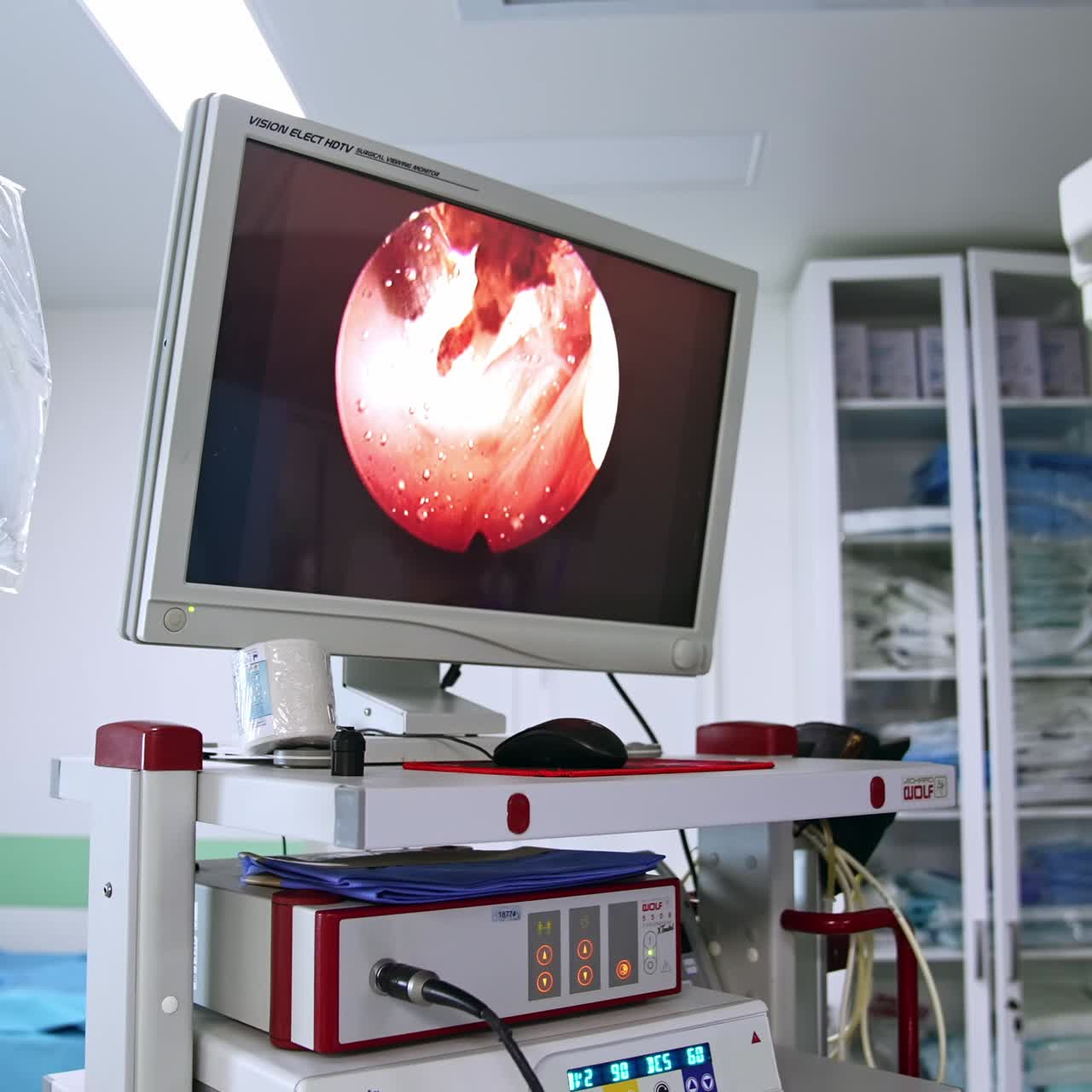 Monitor showing inner organ under operation. Doctors' focused team look at the screen performing surgery