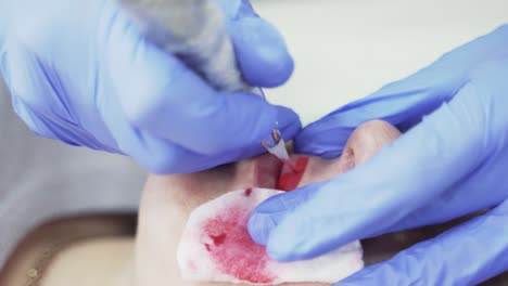 lips tattoo. cosmetologist in blue gloves applying permanent makeup tattoo on lips. professional tattooist making permanent make up. close-up
