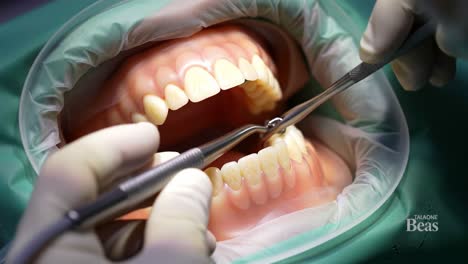 a detailed examination of dental practice focused on oral hygiene and treatment techniques using tools for patient care in a clinical environment