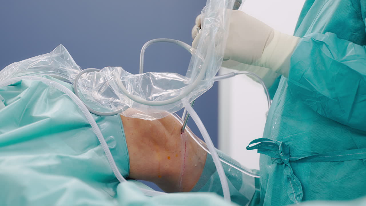 cirujano profesional que realiza cirugía artroscópica de rodilla - vista lateral de cerca