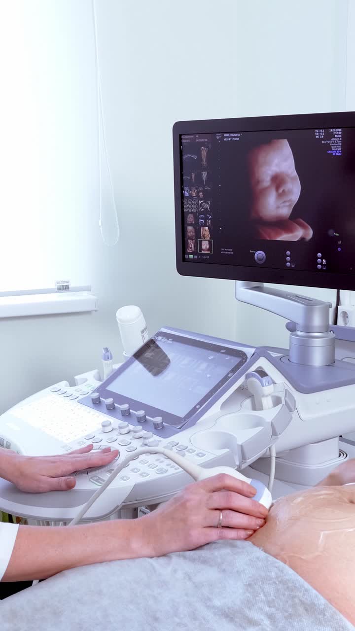 Esame ecografico medico che mostra l'immagine fetale su un monitor con l'assistenza di un professionista sanitario
