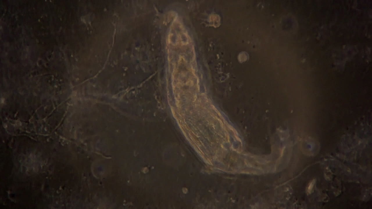 una vista microscópica de un rotífero en iluminación de contraste de fase