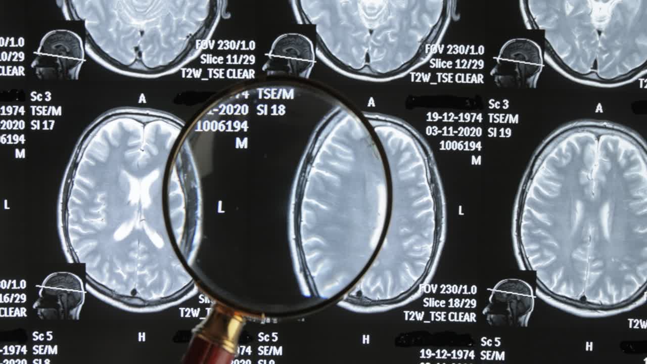 Mri brain scan background, magnetic resonance tomography. The doctor examines the patient's images under a magnifying glass.