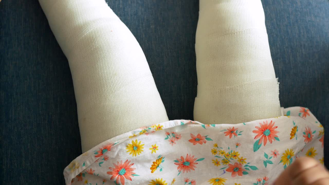 Niño pequeño con vendaje de yeso en la pierna