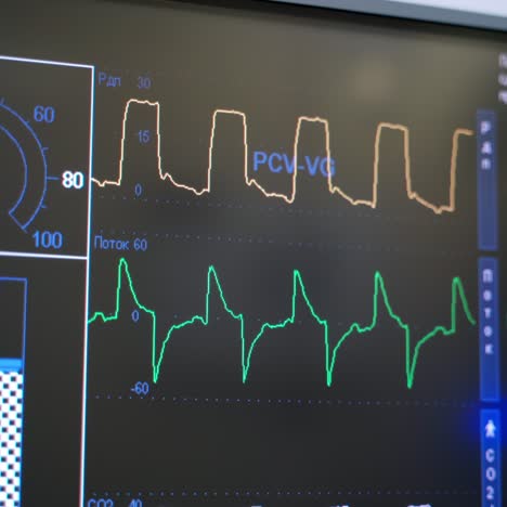 artificial lung ventilation monitor in the intensive care unit. hospital, surgical operating room. life saving. ventilation of the lungs with oxygen.