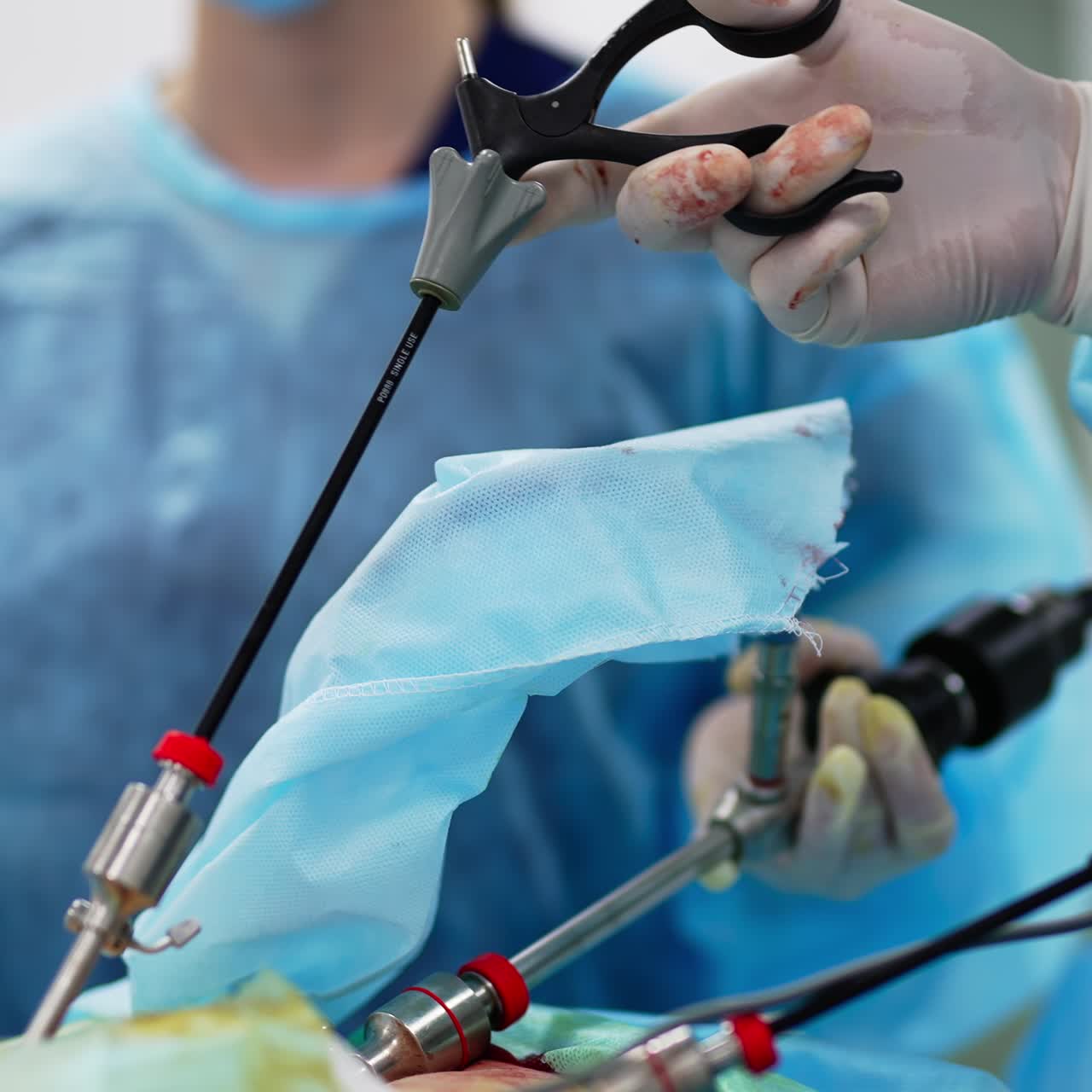 Gloved hands stained with blood use modern surgery instruments. Close up. Doctors conducting operation