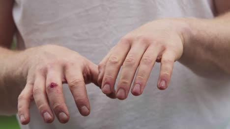 close-up human hand with injured