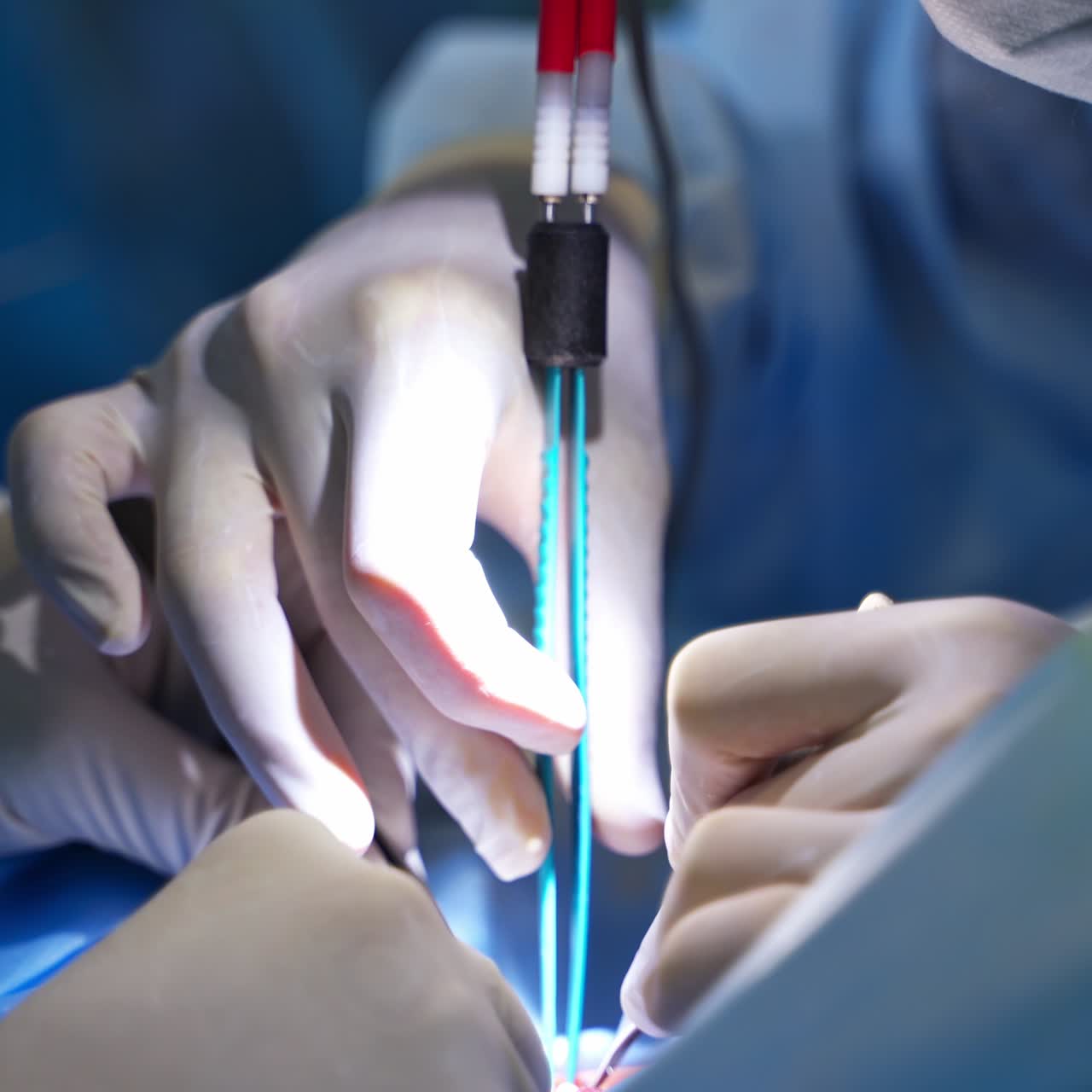 Usage of advanced equipment in modern surgery. Surgeons use metal tools as well as electrical device for operation. Close up. Blurred backdrop