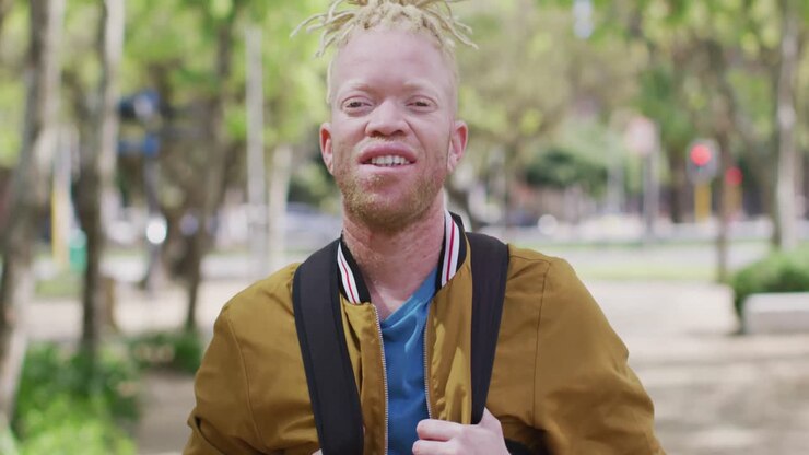 Ritratto di uomo afroamericano albino sorridente con i dreadlock al parco che guarda la fotocamera