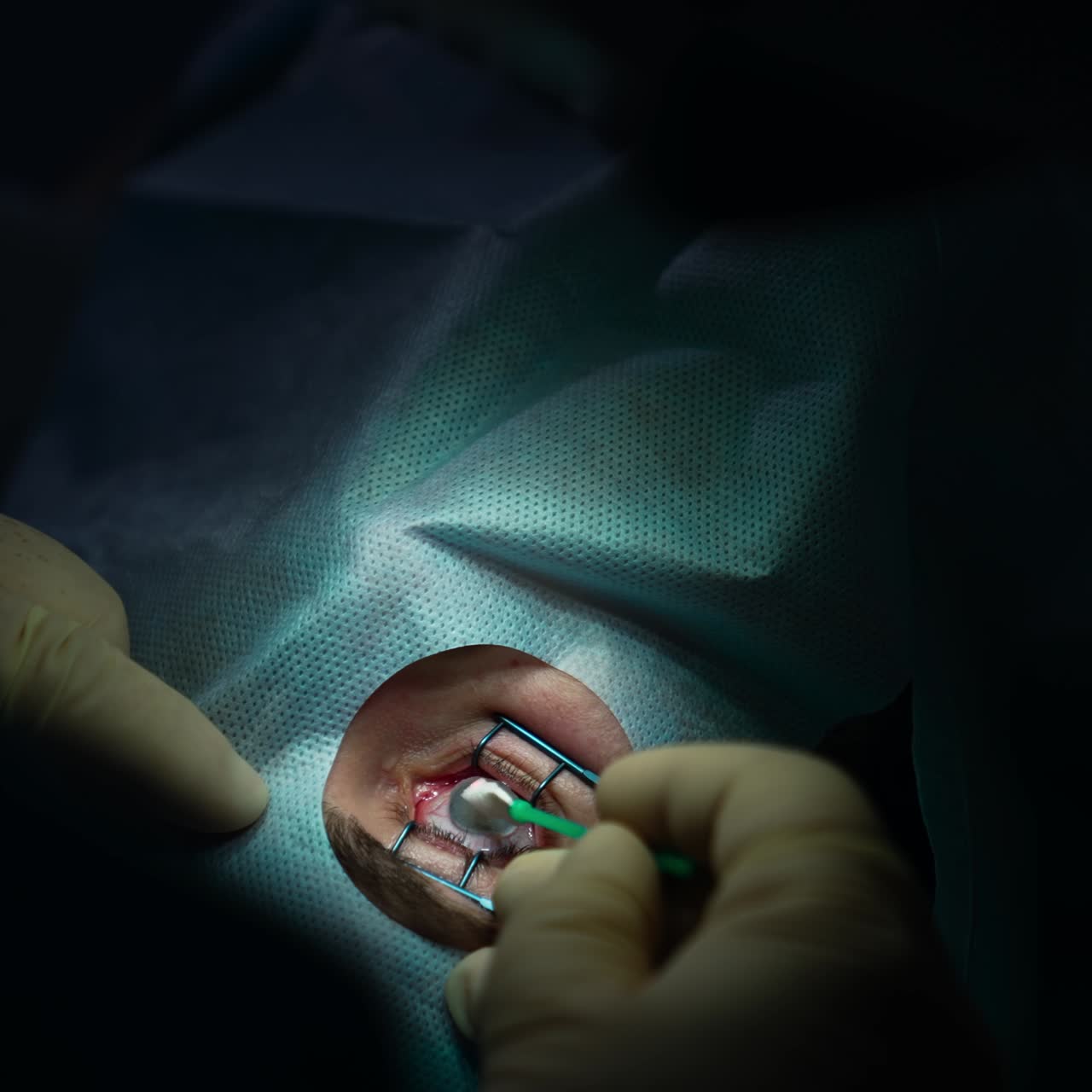 Microscope professional eyesight operating. Professional laser eye correction