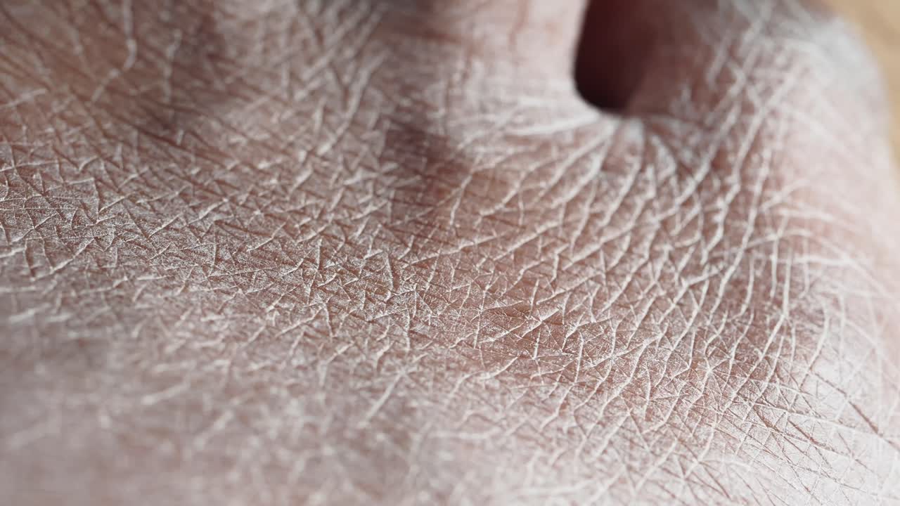 Close-up of dry skin