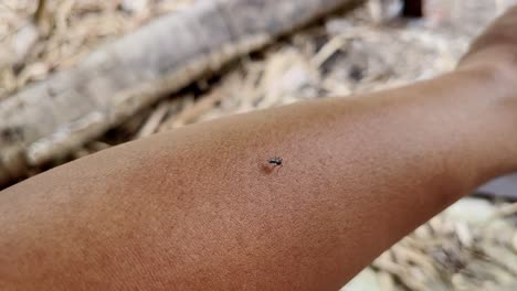 a mosquito bite on human hand skin