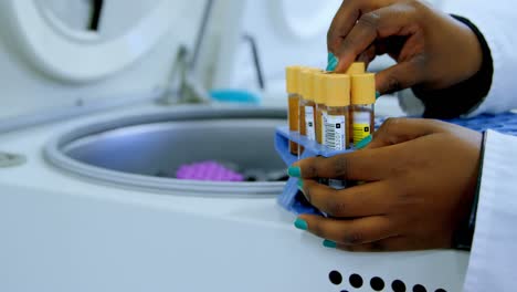 técnico de laboratorio tomando muestras de plasma sanguíneo de la centrífuga 4k