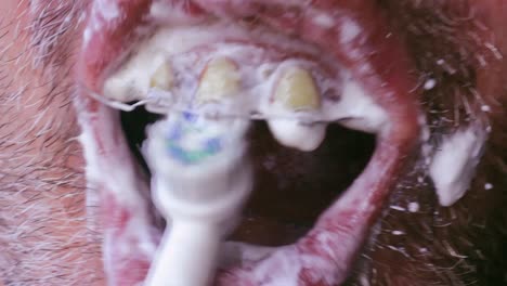 funny close up of an ugly toothy mouth with yellow teeth and broken braces brushing teeth