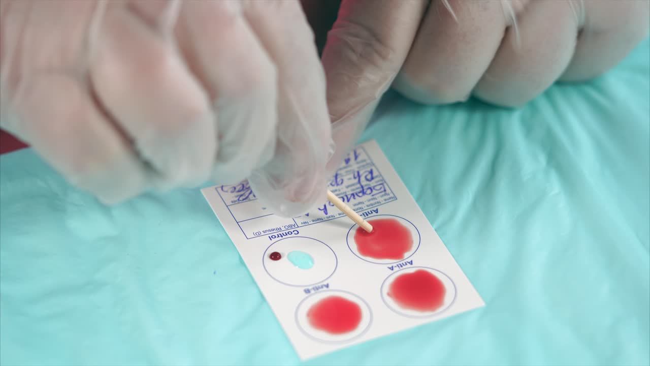 Blood Antibody Test Procedure