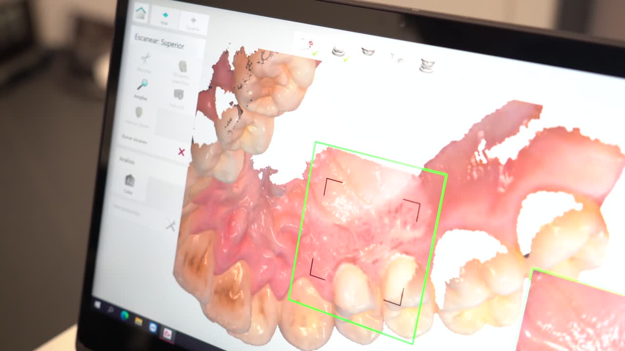 Dental scan on a laptop screen