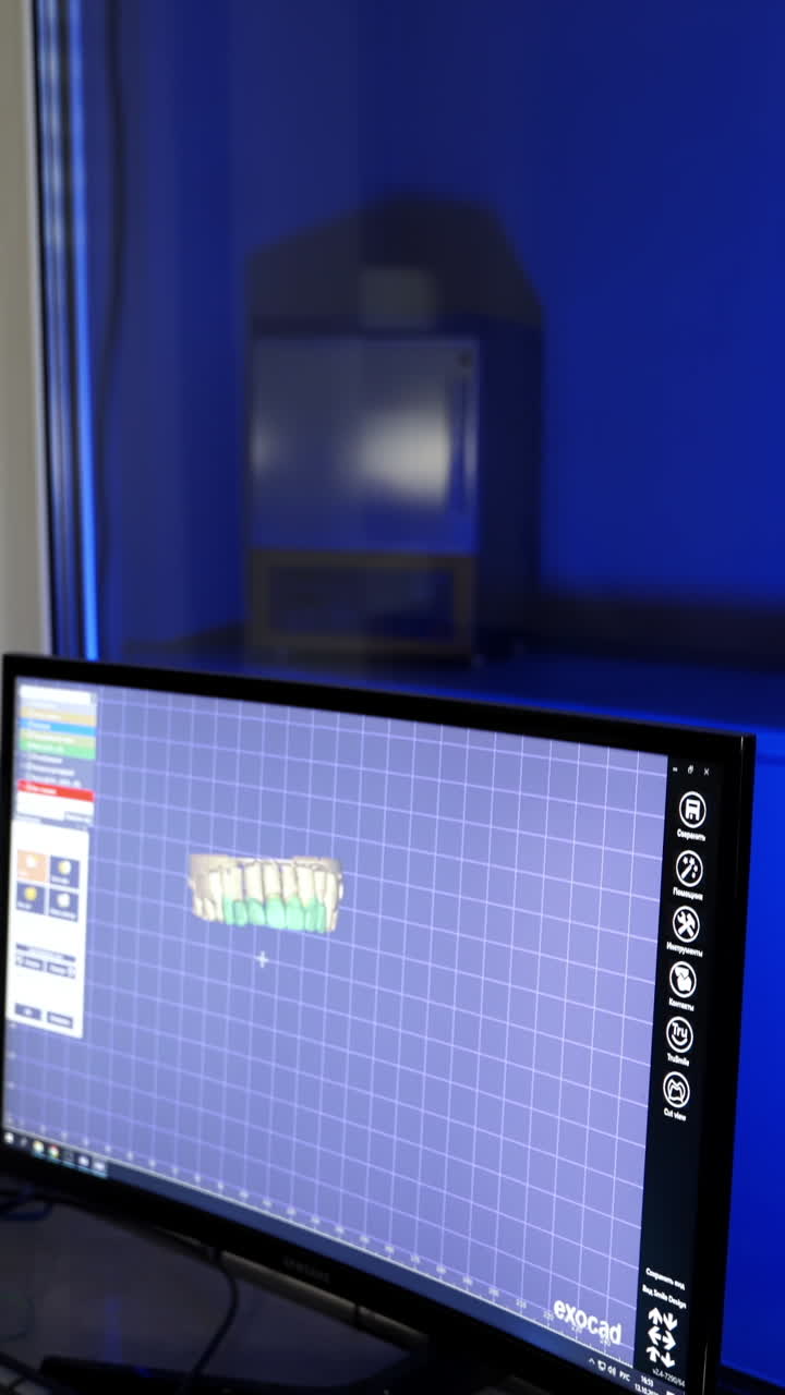 New technologies in dentistry. Technician working on the computer in the laboratory. Dental milling machine in blue light. Vertical video