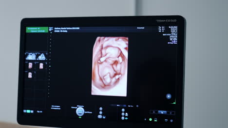 3d image of a baby in the mother's womb. screen of ultrasonic equipment during examination of pregnant woman. close up.