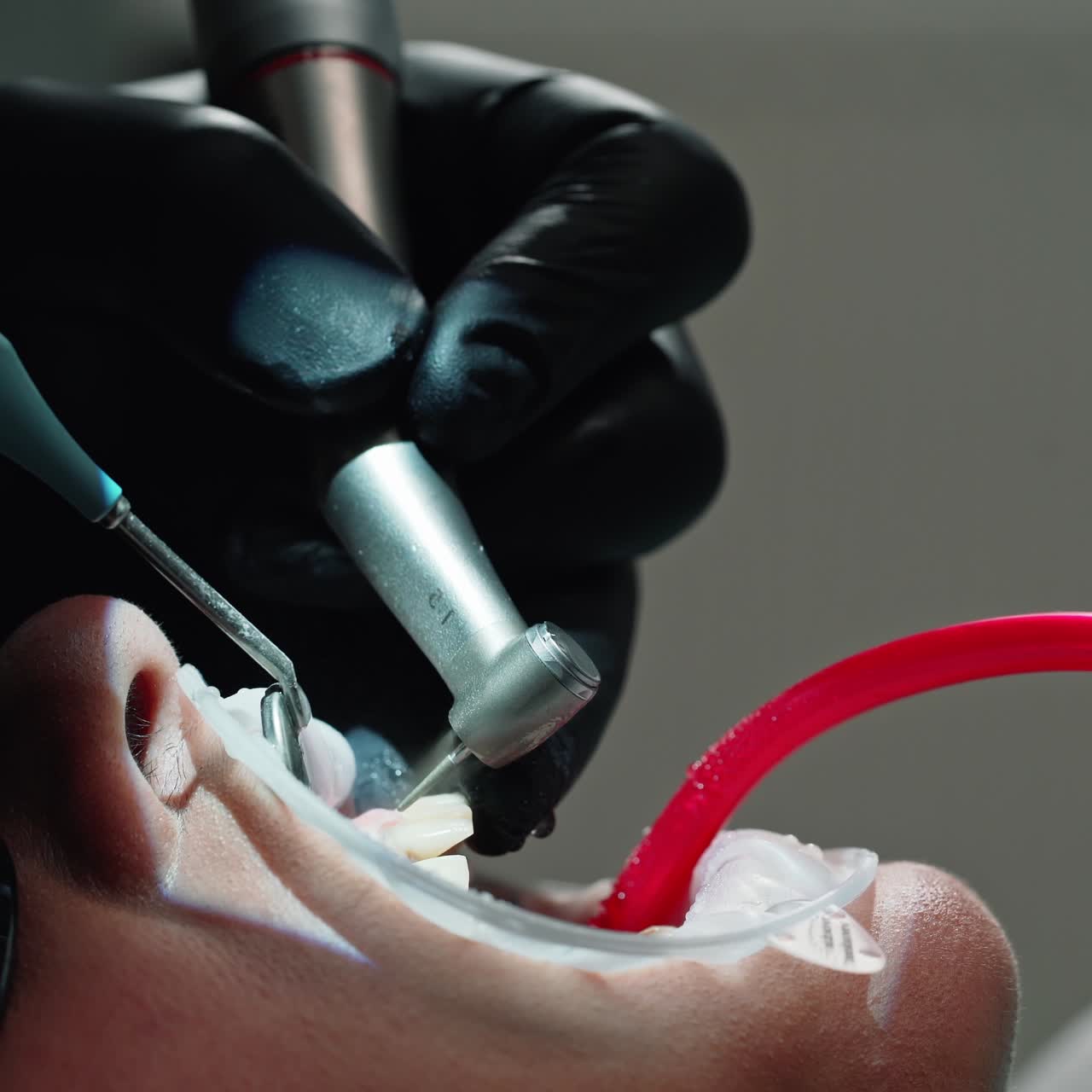 Dentist performs medical manipulations