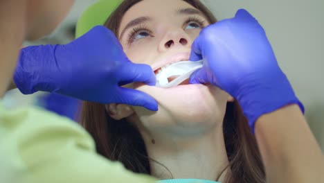 Zahnarzt-Bereitet-Die-Mundhöhle-Des-Patienten-Auf-Die-Zahnaufhellung-Vor