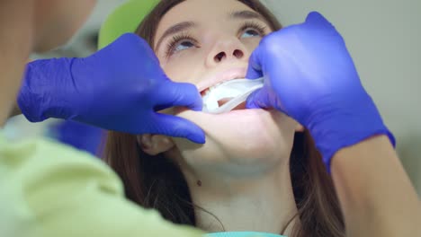 dentist preparing patient oral cavity for teeth whitening procedure