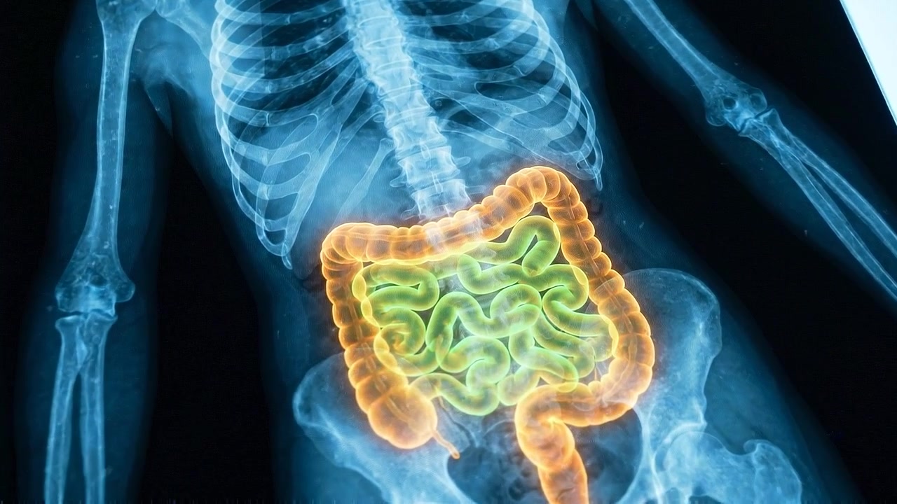 Medical X-ray Scan of Human Digestive System