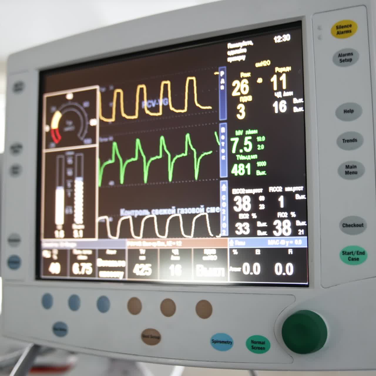 Una mano con un guanto blu in lattice preme il pulsante sullo schermo dell'apparecchiatura. Un'anestesista che lavora in sala operatoria guarda i monitor.