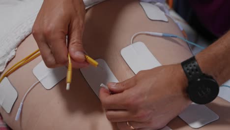 close up of male therapist adjusting electrode pads on the lower back of a patient during treatment