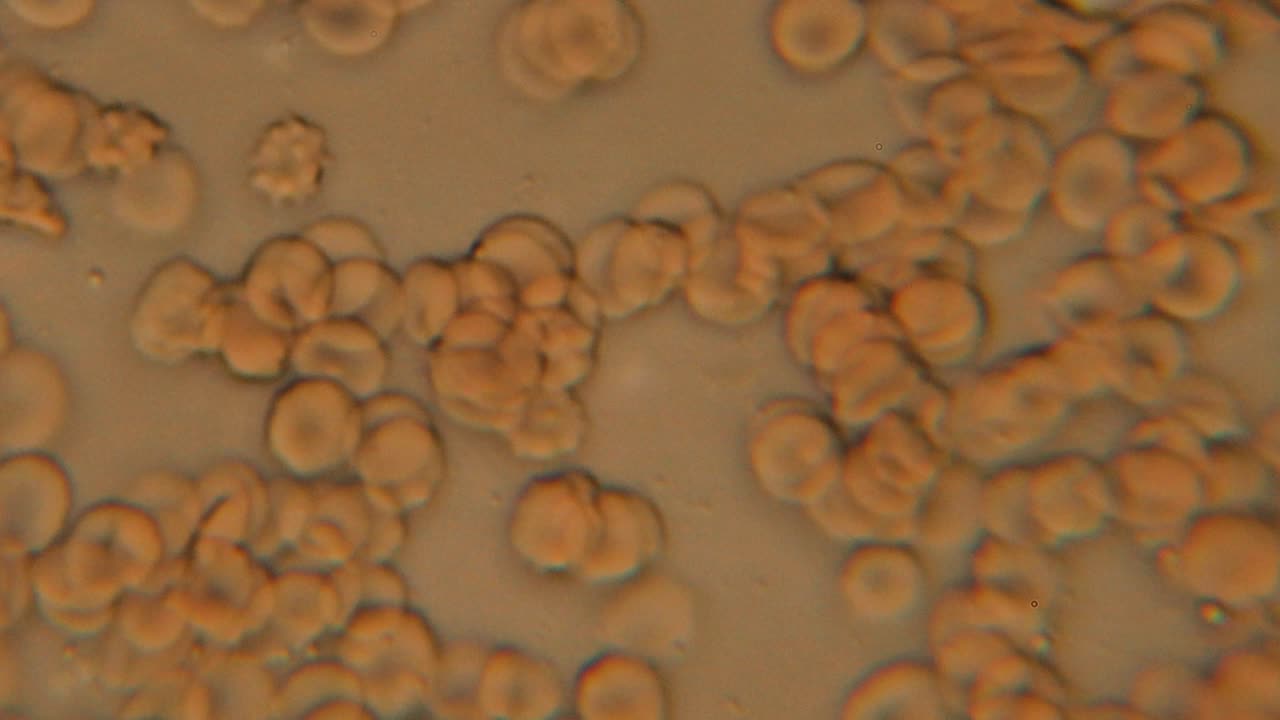 Immagine microscopica che mostra globuli rossi raggruppati con forme rotonde distinte, simili a dischi, visti ad alto ingrandimento. Ideale per contesti medici o scientifici.