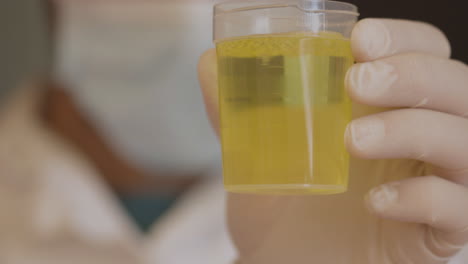 doctor prepares a urine specimen for analysis. closeup view